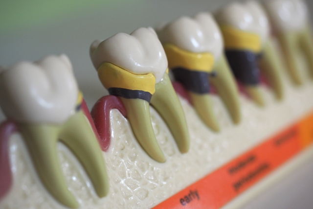 分倍河原・中河原（府中市）の歯医者、はんざわ歯科クリニックの歯周病治療